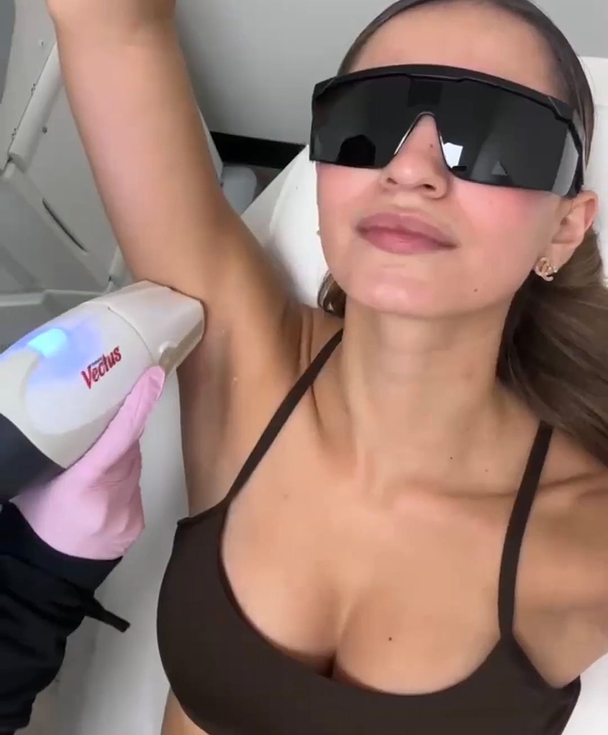 Laser hair removal treatment in progress.
